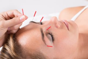 Acupuncture Daphne AL TN