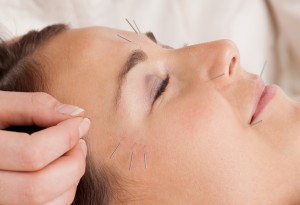 Fairhope Acupuncture