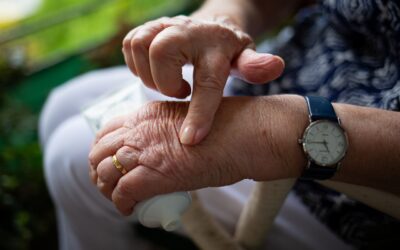 Acupuncture and Functional Medicine Daphne:  Rheumatoid Arthritis